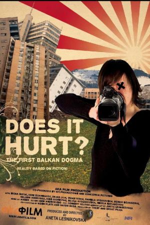 Does it Hurt? (2007) poster
